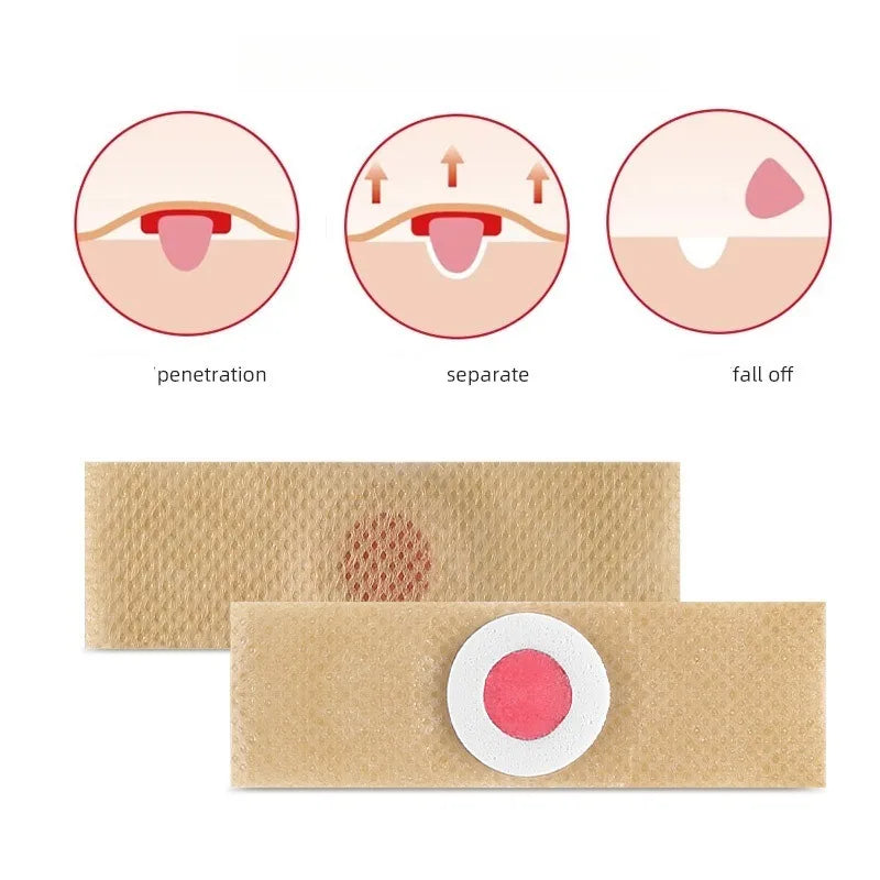 24Pcs Foot Care Corn Pads – Softening Plasters for Callus & Hard Skin Relief